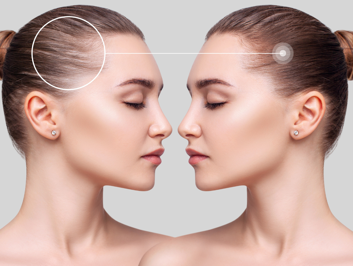 trichology-hair-loss-consultation-weymouth.png